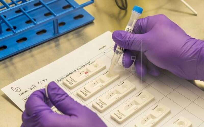 Imagen de archivo de unas pruebas de antígenos (Foto EFE)